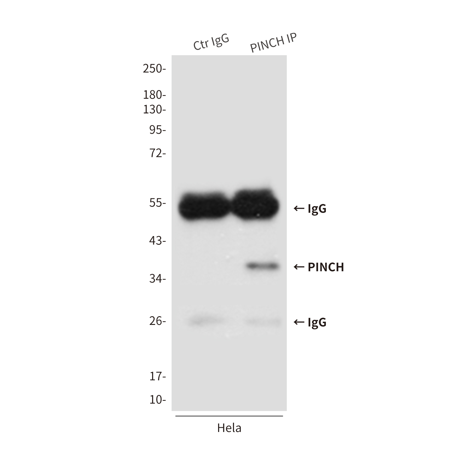 1 - PINCH (3C12) Mouse mAb AP53507