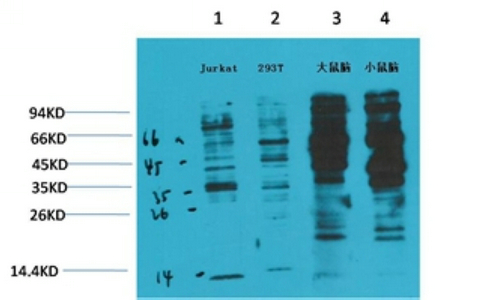 1 - Phospho-Tyrosine (6G6) Mouse mAb AP53519