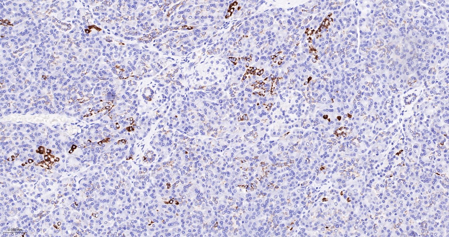 14 - PCCB Recombinant Mouse mAb AP94485