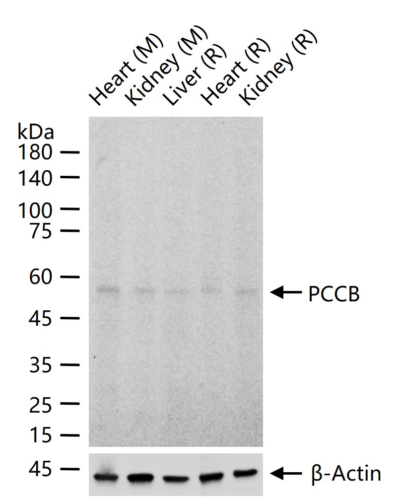 1 - PCCB Recombinant Mouse mAb AP94485
