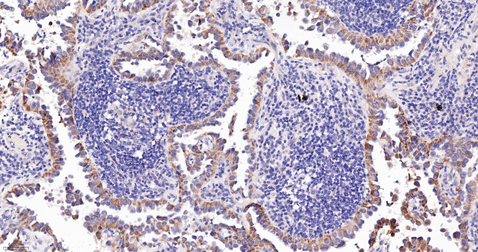 14 - PCCB Recombinant Mouse mAb AP94485