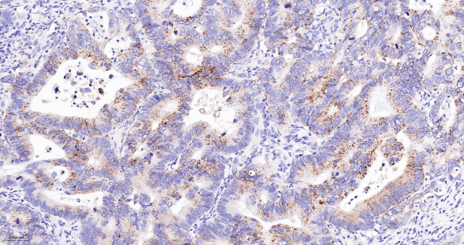 14 - PCCB Recombinant Mouse mAb AP94485