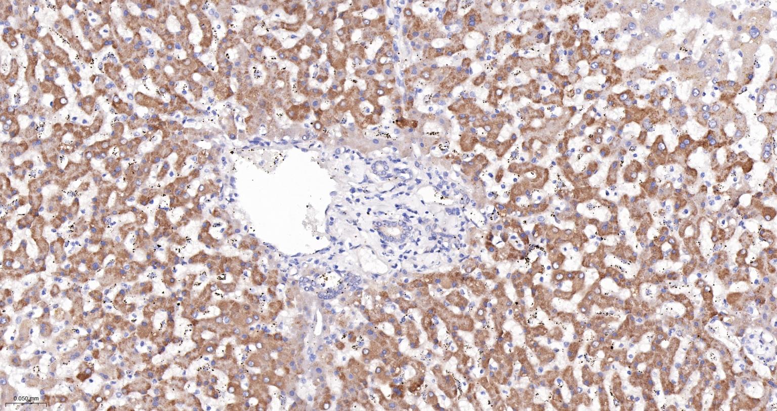 14 - PCCB Recombinant Mouse mAb AP94485