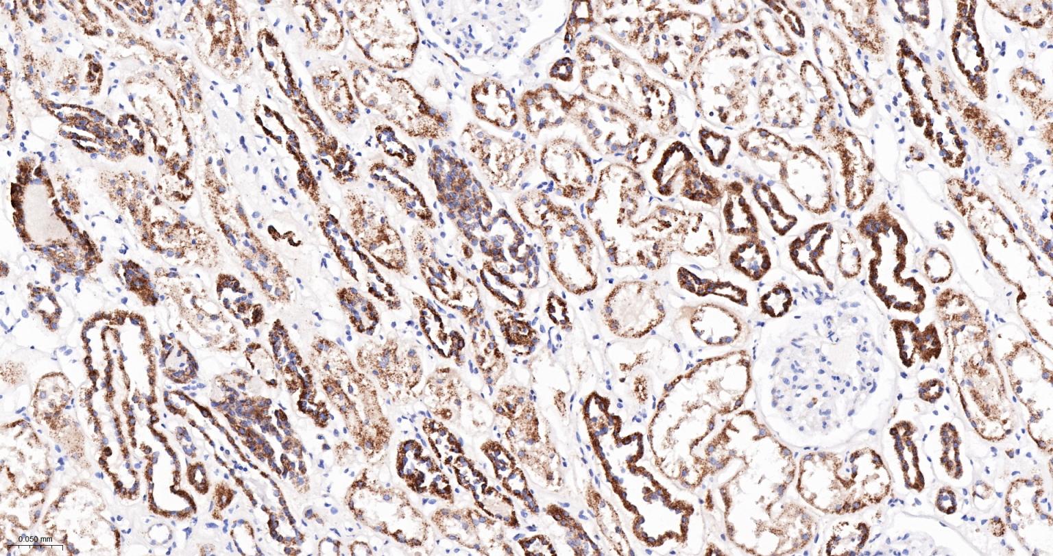 14 - PCCB Recombinant Mouse mAb AP94485