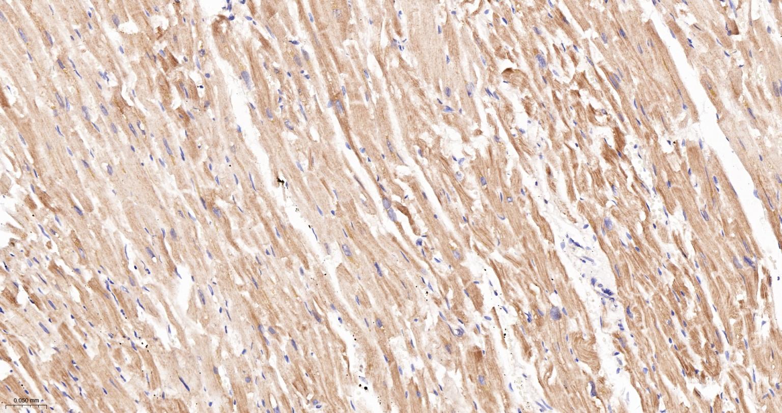 14 - PCCB Recombinant Mouse mAb AP94485