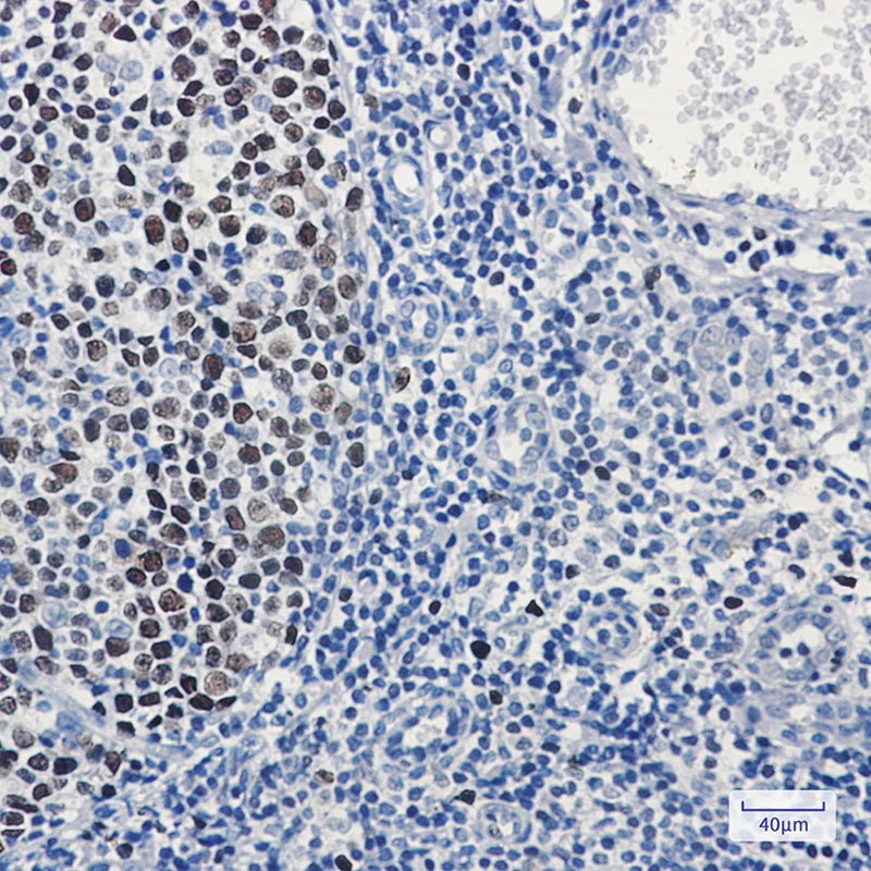 2 - MCM3 Rabbit mAb AP74816