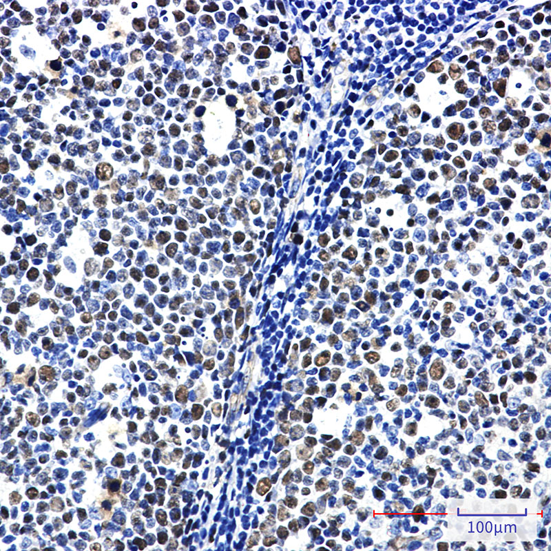 2 - MCM6 Rabbit mAb AP74817