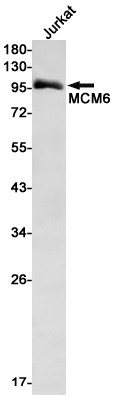 1 - MCM6 Rabbit mAb AP74817