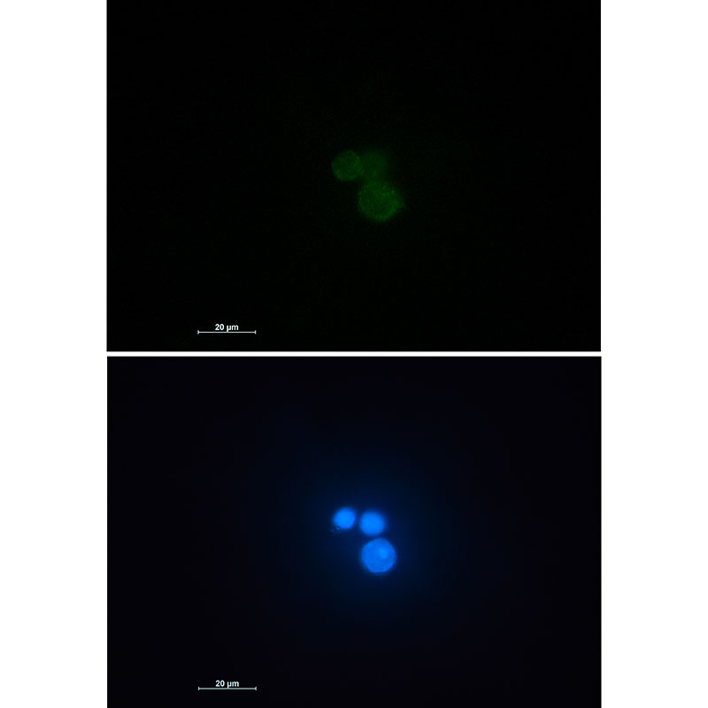 1 - Matrin 3 Rabbit mAb AP74822