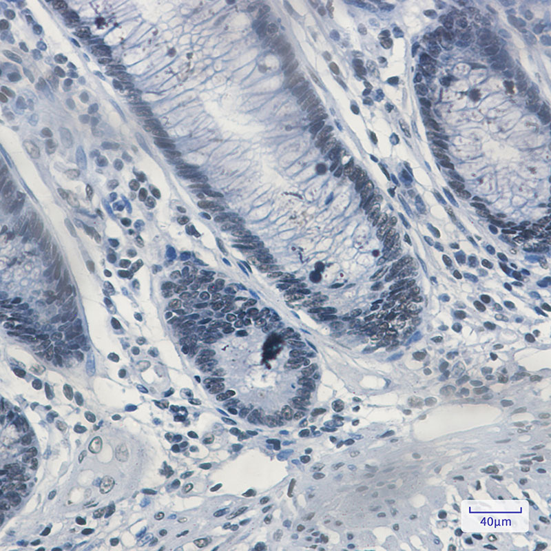 8 - Matrin 3 Rabbit mAb AP74822