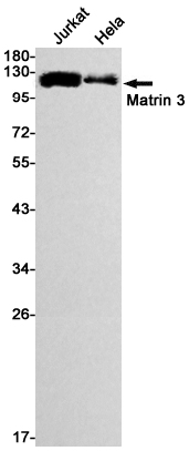 2 - Matrin 3 Rabbit mAb AP74822
