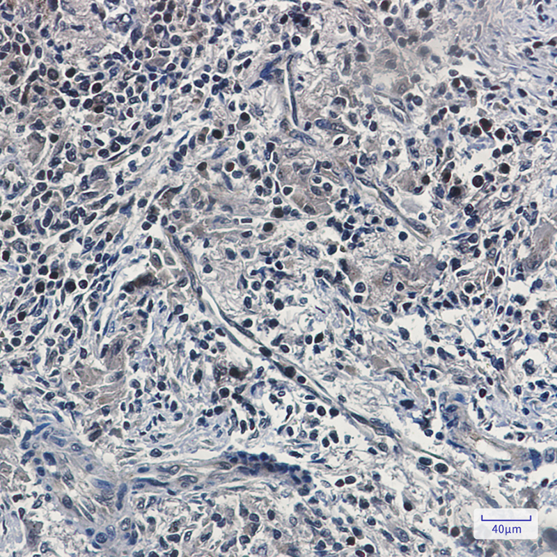 5 - [KD]UFM1 Rabbit mAb AP74823