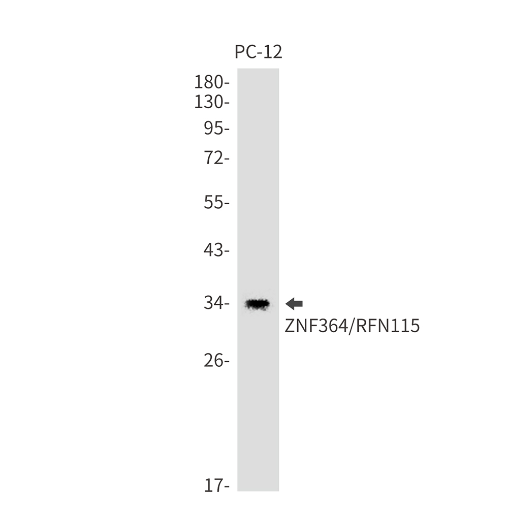1 - RNF115 Rabbit mAb AP74824