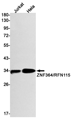 0 - RNF115 Rabbit mAb AP74824