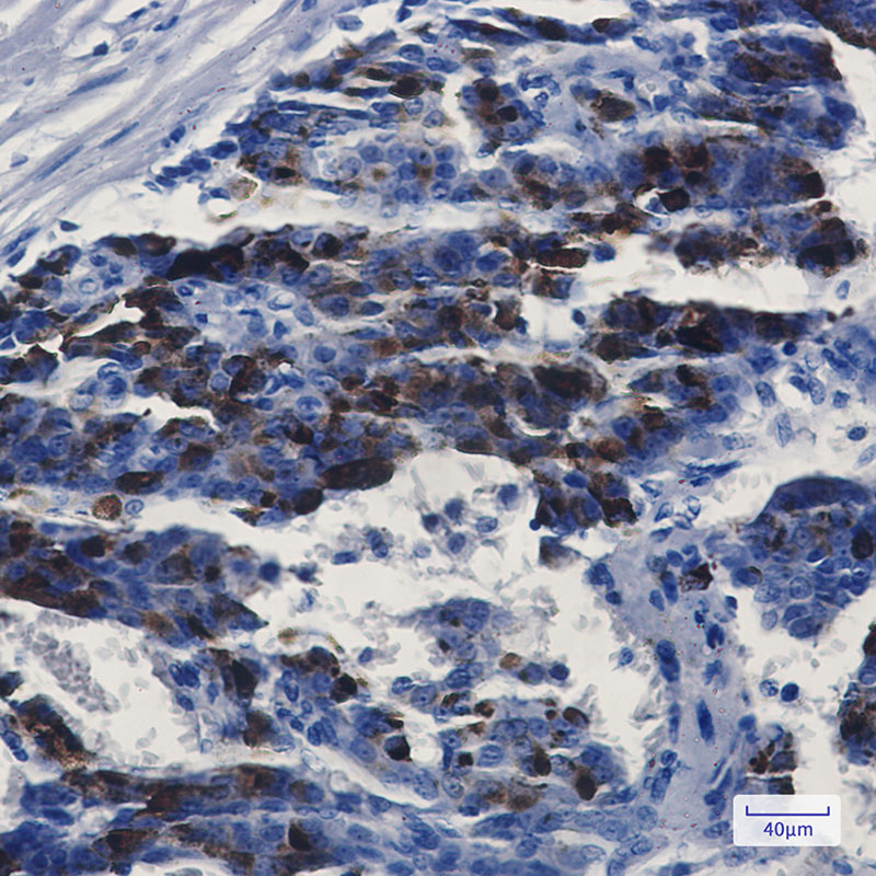 2 - MMP14 Rabbit mAb AP74828
