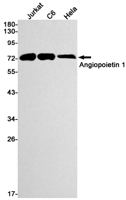 1 - ANGPT1 Rabbit mAb AP74829
