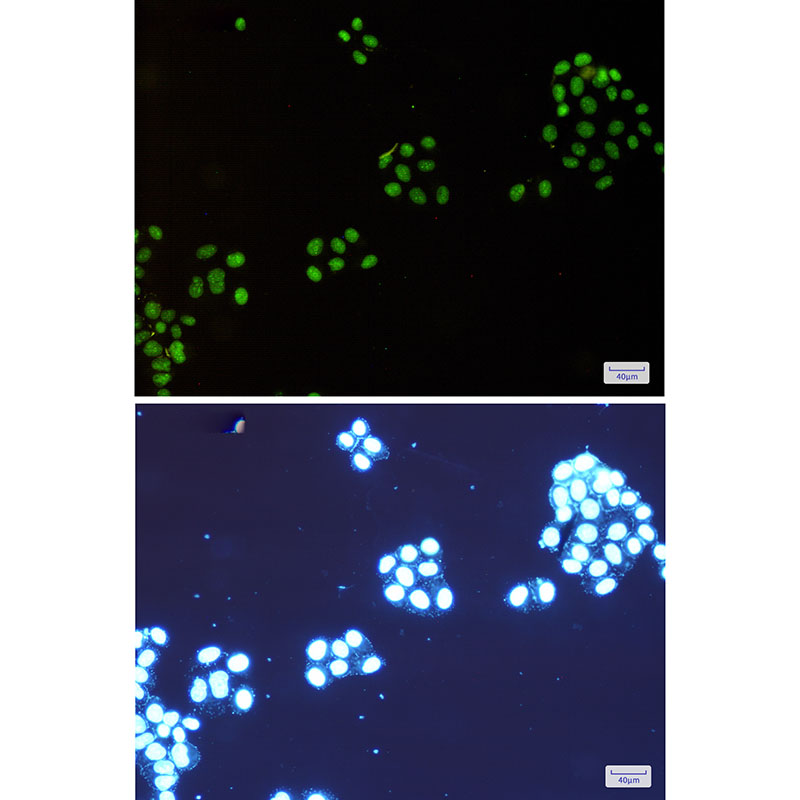 2 - NAT10 Rabbit mAb AP74830