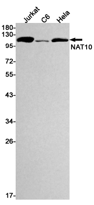 1 - NAT10 Rabbit mAb AP74830