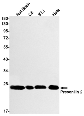 1 - Presenilin 2/AD5 Rabbit mAb AP74834