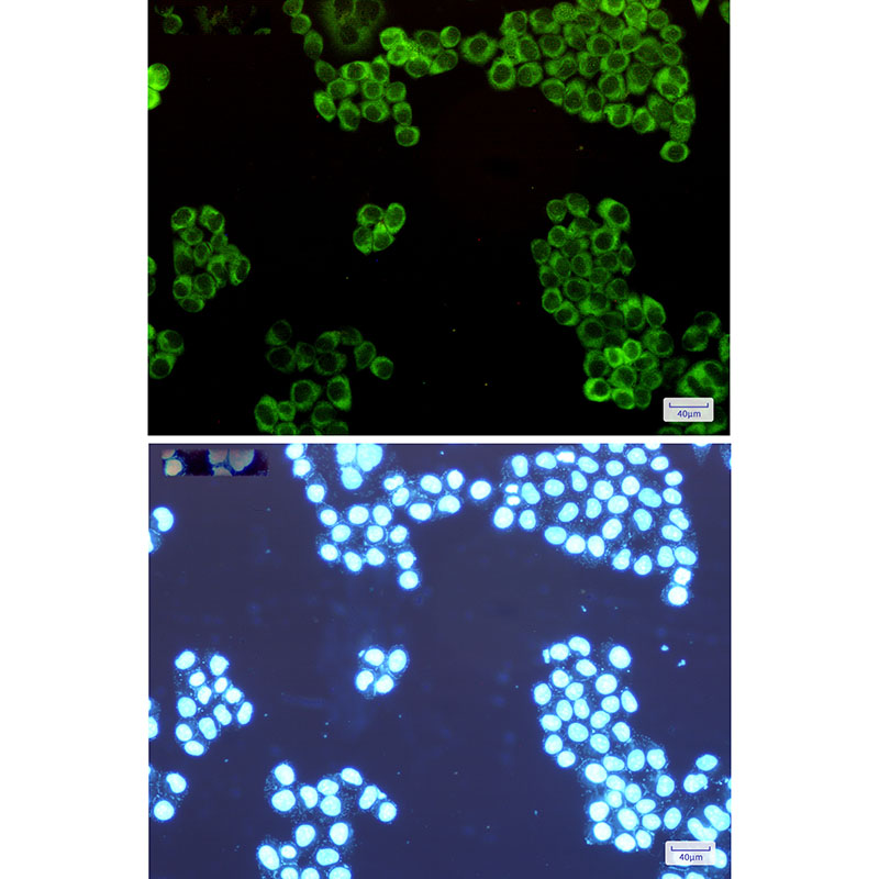 4 - Tryptophanyl tRNA synthetase Rabbit mAb AP74835