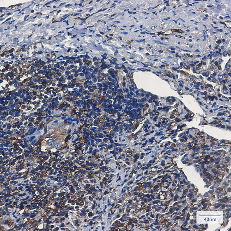 8 - Tryptophanyl tRNA synthetase Rabbit mAb AP74835