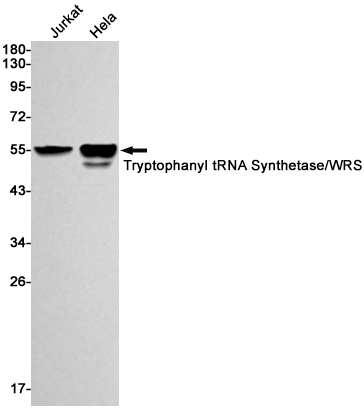 1 - Tryptophanyl tRNA synthetase Rabbit mAb AP74835