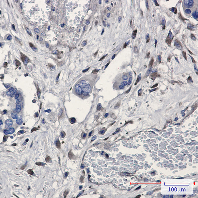 2 - GNB2 Rabbit mAb AP74837