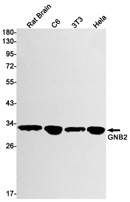 1 - GNB2 Rabbit mAb AP74837