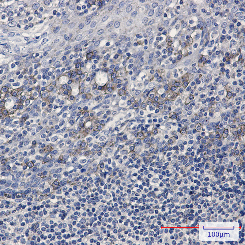 2 - CD32B Rabbit mAb AP74838