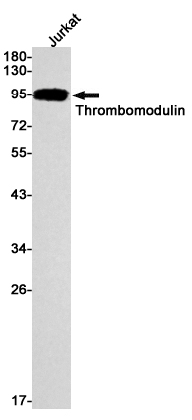 2 - Thrombomodulin Rabbit mAb AP74839