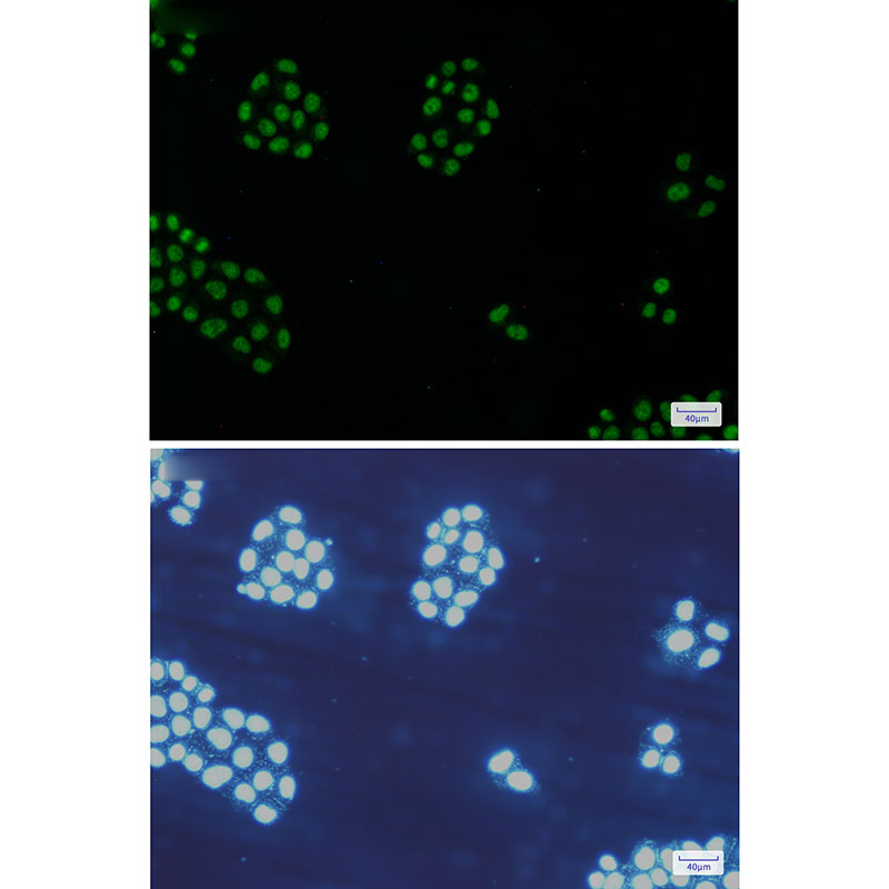 3 - [KD]MCM5 Rabbit mAb AP74843
