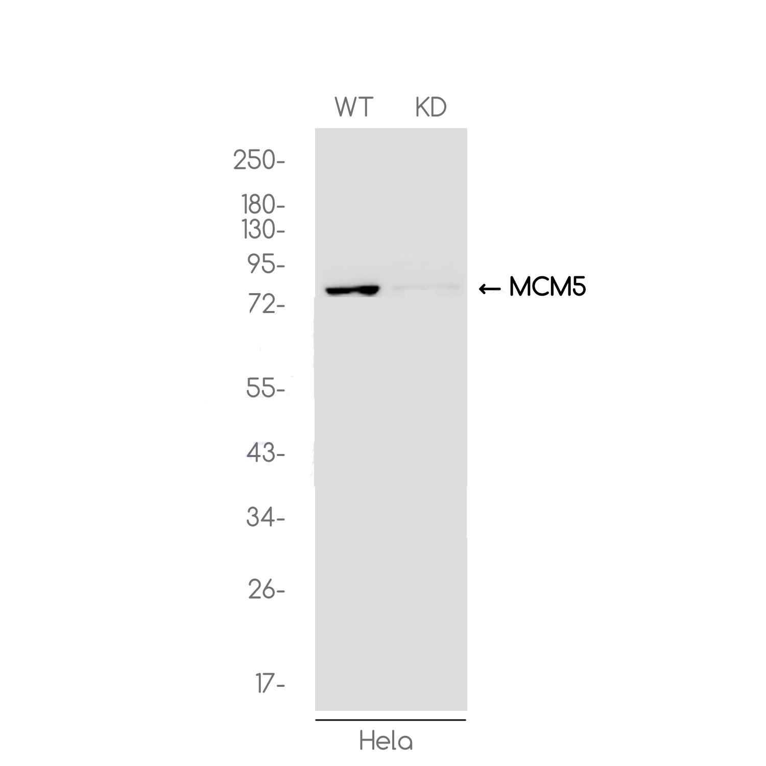 1 - [KD]MCM5 Rabbit mAb AP74843