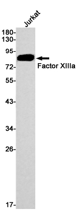 1 - Factor XIIIa Rabbit mAb AP74844