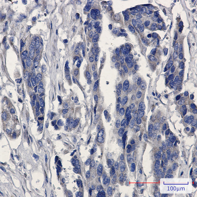 2 - MGST1 Rabbit mAb AP74846
