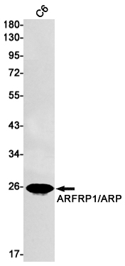 1 - ARFRP1/ARP Rabbit mAb AP74847
