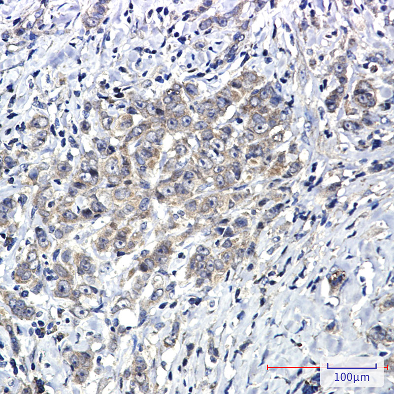 8 - [KO]SHP2 Rabbit mAb AP74848