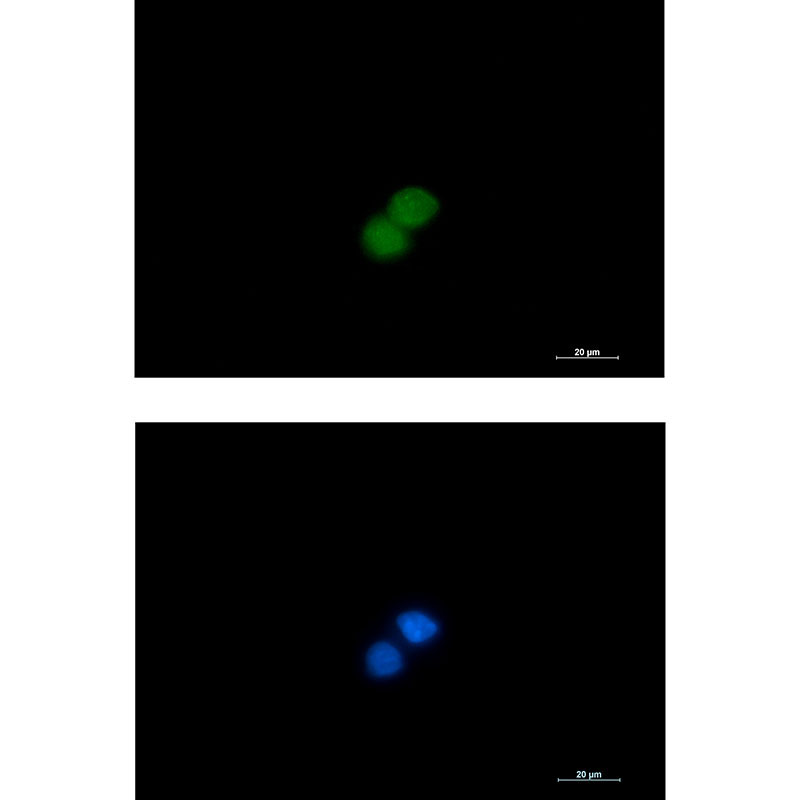 1 - MSP/MST1 Rabbit mAb AP74850