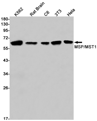 2 - MSP/MST1 Rabbit mAb AP74850