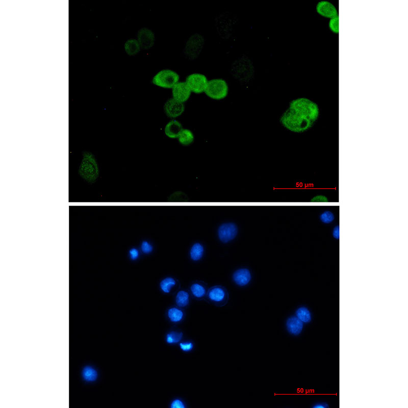 8 - [KO]CRABP2 Rabbit mAb AP74852