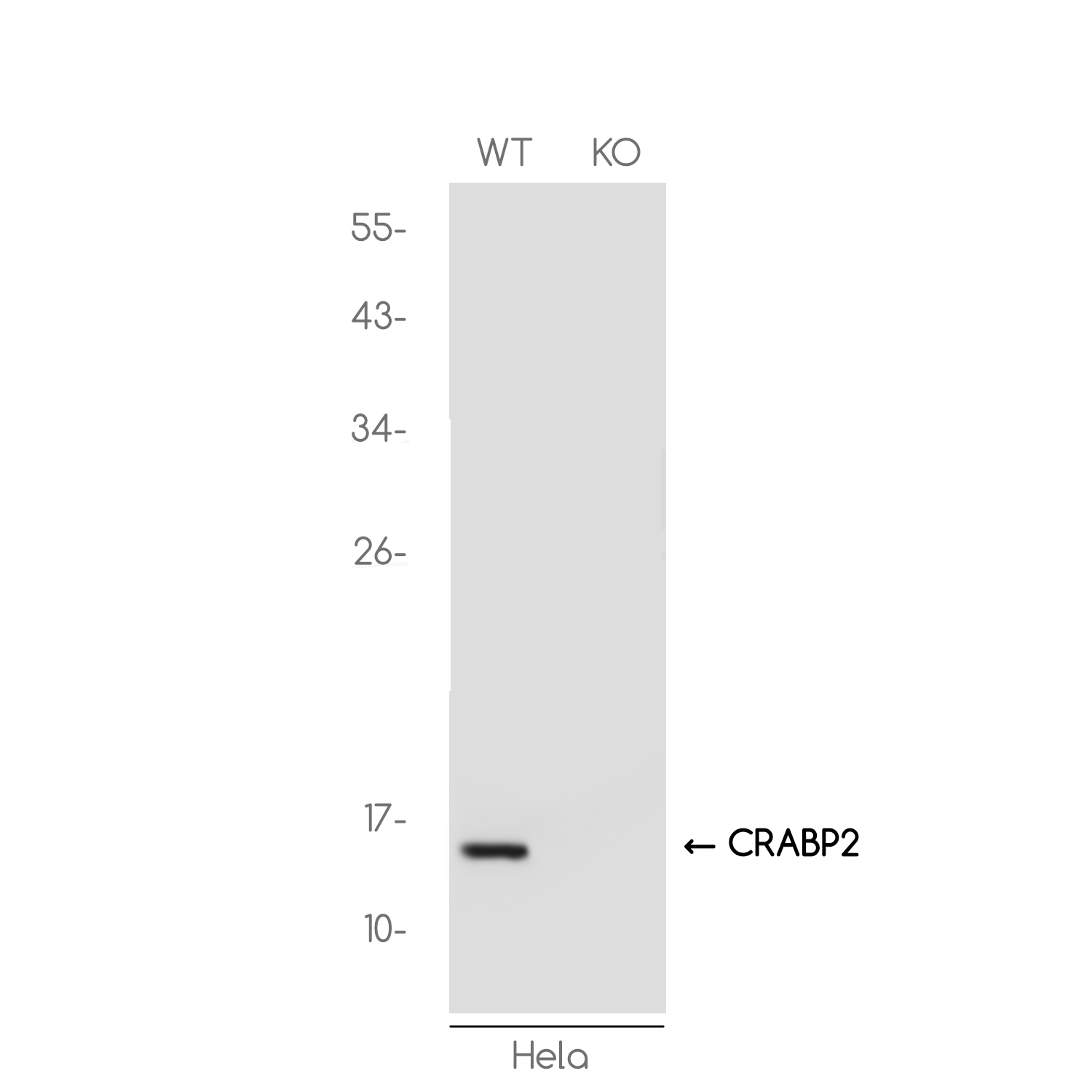 1 - [KO]CRABP2 Rabbit mAb AP74852