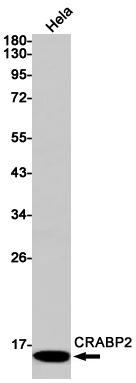2 - [KO]CRABP2 Rabbit mAb AP74852