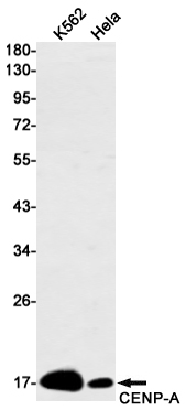 1 - [KD]CENPA Rabbit mAb AP74853