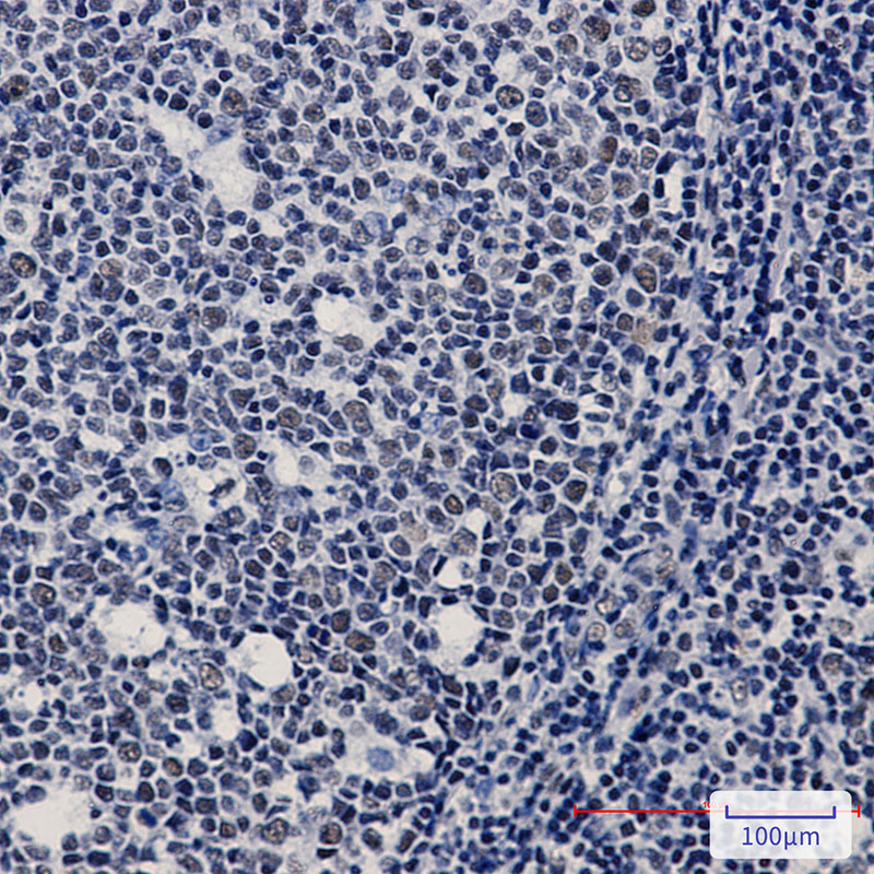 2 - WTAP Rabbit mAb AP74855