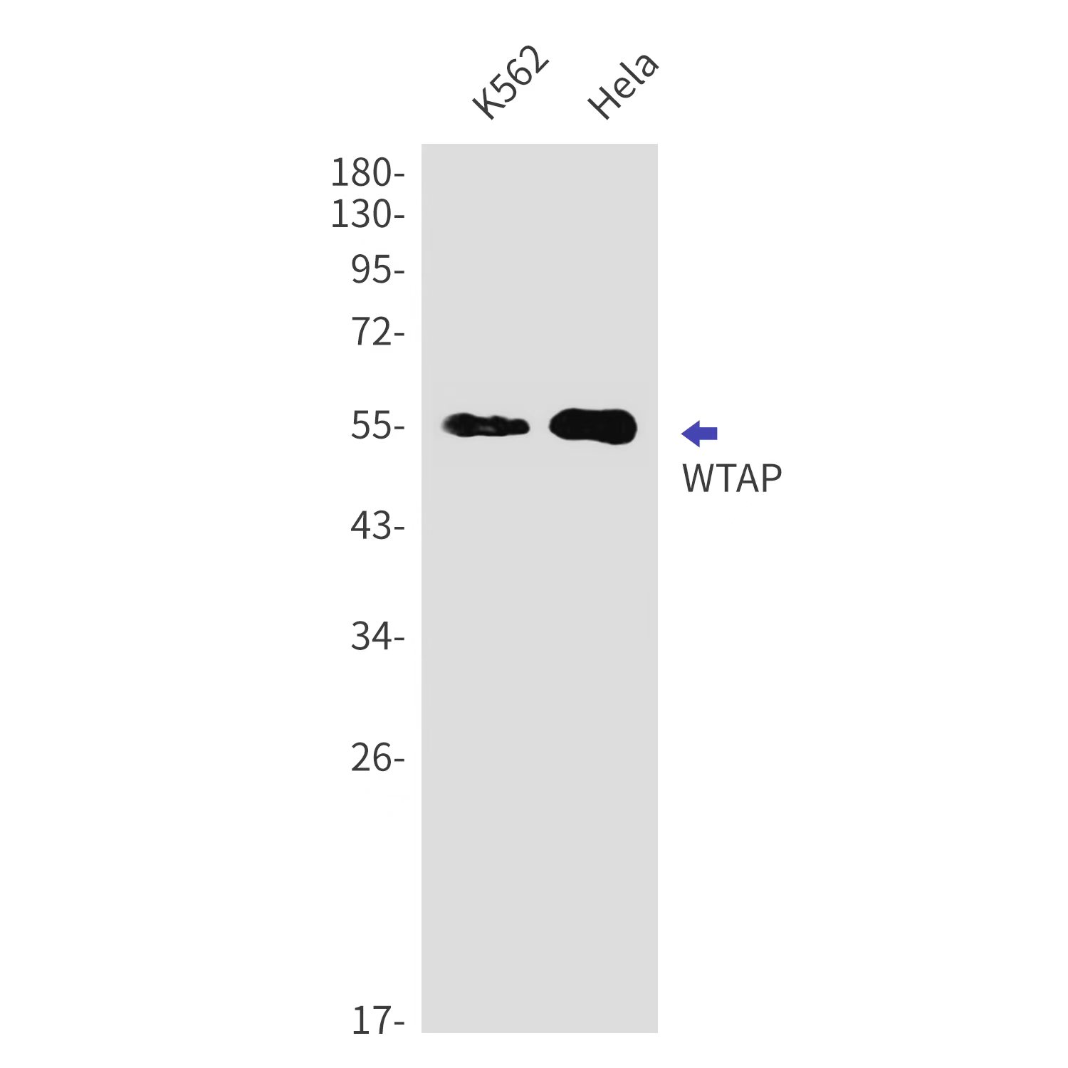 1 - WTAP Rabbit mAb AP74855