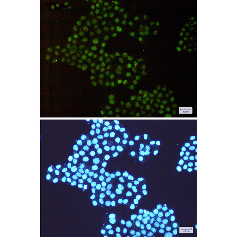 2 - HTF9C/TRMT2A Rabbit mAb AP74858