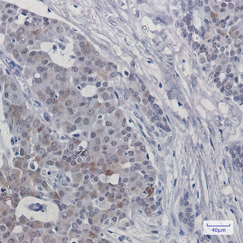 8 - HTF9C/TRMT2A Rabbit mAb AP74858