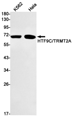 1 - HTF9C/TRMT2A Rabbit mAb AP74858
