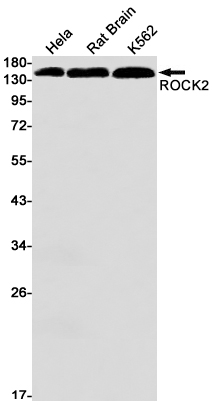 1 - ROCK2 Rabbit mAb AP74859