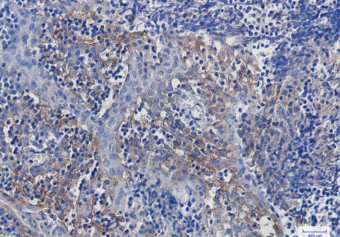 0 - [KO]Integrin alpha V Rabbit mAb AP74861