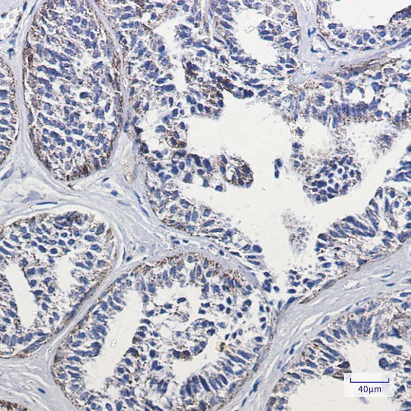 8 - Lipoamide Dehydrogenase Rabbit mAb AP74870